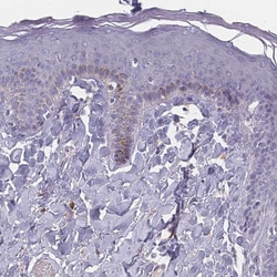 Invitrogen SLC35E4 Polyclonal Antibody 100 &mu;L; Unconjugated:Antibodies,