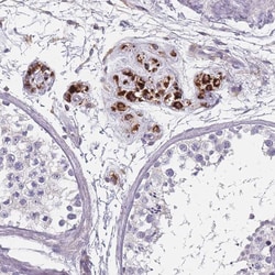 Invitrogen SLC35E4 Polyclonal Antibody 100 &mu;L; Unconjugated:Antibodies,