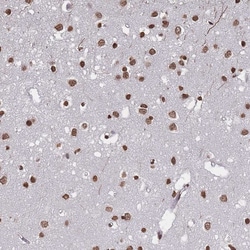 Invitrogen PLEKHG5 Polyclonal Antibody 100 &mu;L; Unconjugated:Antibodies,
