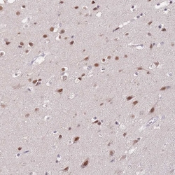Invitrogen PUS10 Polyclonal Antibody 100 &mu;L; Unconjugated:Antibodies,