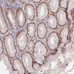 Invitrogen PUS10 Polyclonal Antibody 100 &mu;L; Unconjugated:Antibodies,