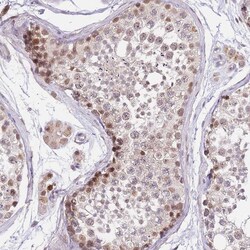 Invitrogen PUS10 Polyclonal Antibody 100 &mu;L; Unconjugated:Antibodies,