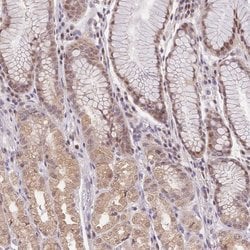 Invitrogen PUS10 Polyclonal Antibody 100 &mu;L; Unconjugated:Antibodies,