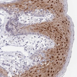 Invitrogen ZNF142 Polyclonal Antibody 100 &mu;L; Unconjugated:Antibodies,