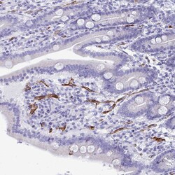 Invitrogen KRIT1 Polyclonal Antibody 100 &mu;L; Unconjugated:Antibodies,