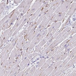 Invitrogen KRIT1 Polyclonal Antibody 100 &mu;L; Unconjugated:Antibodies,