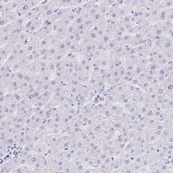 Invitrogen KRIT1 Polyclonal Antibody 100 &mu;L; Unconjugated:Antibodies,