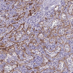 Invitrogen KRIT1 Polyclonal Antibody 100 &mu;L; Unconjugated:Antibodies,