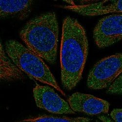 Invitrogen CNOT1 Polyclonal Antibody 100 &mu;L; Unconjugated:Antibodies,