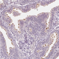 Invitrogen C1orf194 Polyclonal Antibody 100 &mu;L; Unconjugated:Antibodies,