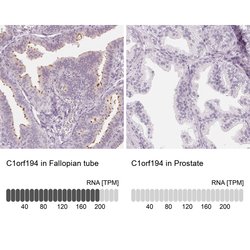 Invitrogen C1orf194 Polyclonal Antibody 100 &mu;L; Unconjugated:Antibodies,