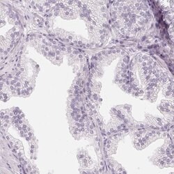 Invitrogen C1orf194 Polyclonal Antibody 100 &mu;L; Unconjugated:Antibodies,