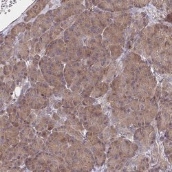 Invitrogen BAP29 Polyclonal Antibody 100 &mu;L; Unconjugated:Antibodies,
