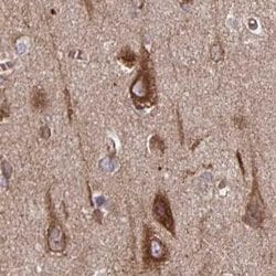 Invitrogen BAP29 Polyclonal Antibody 100 &mu;L; Unconjugated:Antibodies,
