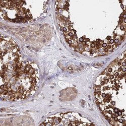 Invitrogen BAP29 Polyclonal Antibody 100 &mu;L; Unconjugated:Antibodies,