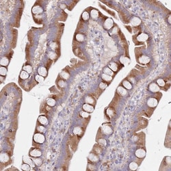 Invitrogen SPATS1 Polyclonal Antibody 100 &mu;L; Unconjugated:Antibodies,