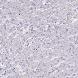 Invitrogen SSUH2 Polyclonal Antibody 100 &mu;L; Unconjugated:Antibodies,
