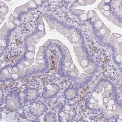 Invitrogen SSUH2 Polyclonal Antibody 100 &mu;L; Unconjugated:Antibodies,