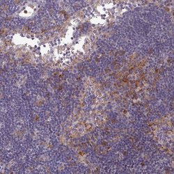 COL8A2 Polyclonal Antibody, Invitrogen 100 &mu;L; Unconjugated:Antibodies,