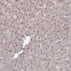 COL8A2 Polyclonal Antibody, Invitrogen 100 &mu;L; Unconjugated:Antibodies,
