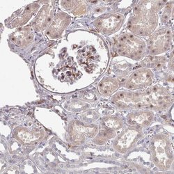 COL8A2 Polyclonal Antibody, Invitrogen 100 &mu;L; Unconjugated:Antibodies,