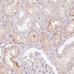 Invitrogen CFHR2 Polyclonal Antibody 100 &mu;L; Unconjugated:Antibodies,