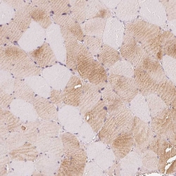 Invitrogen CFHR2 Polyclonal Antibody 100 &mu;L; Unconjugated:Antibodies,