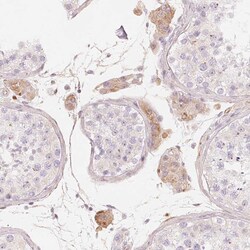 Invitrogen CFHR2 Polyclonal Antibody 100 &mu;L; Unconjugated:Antibodies,