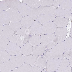 Invitrogen ST3GAL4 Polyclonal Antibody 100 &mu;L; Unconjugated:Antibodies,