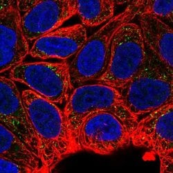 Invitrogen MTMR2 Polyclonal Antibody 100 &mu;L; Unconjugated:Antibodies,