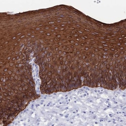 Invitrogen MTMR2 Polyclonal Antibody 100 &mu;L; Unconjugated:Antibodies,