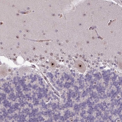 Invitrogen RRN3 Polyclonal Antibody 100 &mu;L; Unconjugated:Antibodies,