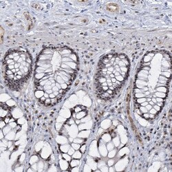 Invitrogen RRN3 Polyclonal Antibody 100 &mu;L; Unconjugated:Antibodies,