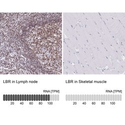 Invitrogen Lamin B Receptor Polyclonal Antibody 100 &mu;L; Unconjugated:Antibodies,