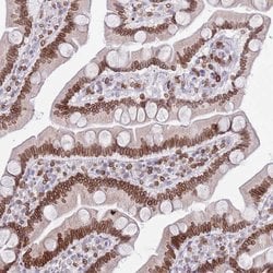 Invitrogen Lamin B Receptor Polyclonal Antibody 100 &mu;L; Unconjugated:Antibodies,