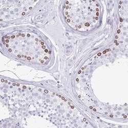 Invitrogen Lamin B Receptor Polyclonal Antibody 100 &mu;L; Unconjugated:Antibodies,
