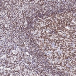 Invitrogen Lamin B Receptor Polyclonal Antibody 100 &mu;L; Unconjugated:Antibodies,