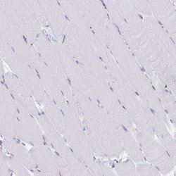 Invitrogen Lamin B Receptor Polyclonal Antibody 100 &mu;L; Unconjugated:Antibodies,