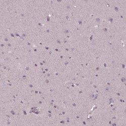 Invitrogen GAL Polyclonal Antibody 100 &mu;L; Unconjugated:Antibodies,