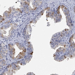 Invitrogen ZNF852 Polyclonal Antibody 100 &mu;L | Buy Online | Invitrogen&trade; | Fisher Scientific