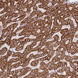 Invitrogen ACSM4 Polyclonal Antibody 100 &mu;L; Unconjugated:Antibodies,