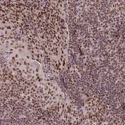 Invitrogen SRSF2 Polyclonal Antibody 100 &mu;L; Unconjugated:Antibodies,