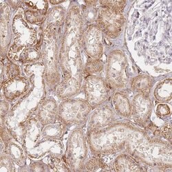 Invitrogen ZNF167 Polyclonal Antibody 100 &mu;L; Unconjugated:Antibodies,