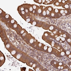 Invitrogen SHB Polyclonal Antibody 100 &mu;L; Unconjugated:Antibodies,