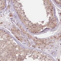 Invitrogen SPATA45 Polyclonal Antibody 100 &mu;L; Unconjugated:Antibodies,