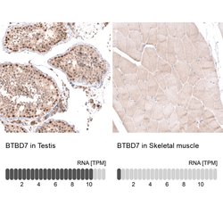 Invitrogen BTBD7 Polyclonal Antibody 100 &mu;L; Unconjugated:Antibodies,