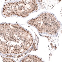 Invitrogen BTBD7 Polyclonal Antibody 100 &mu;L; Unconjugated:Antibodies,