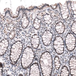 Invitrogen BTBD7 Polyclonal Antibody 100 &mu;L; Unconjugated:Antibodies,