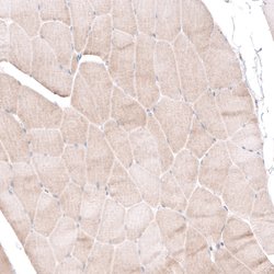 Invitrogen BTBD7 Polyclonal Antibody 100 &mu;L; Unconjugated:Antibodies,