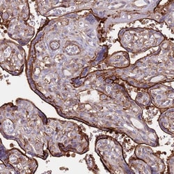 Invitrogen RNF144A Polyclonal Antibody 100 &mu;L; Unconjugated:Antibodies,